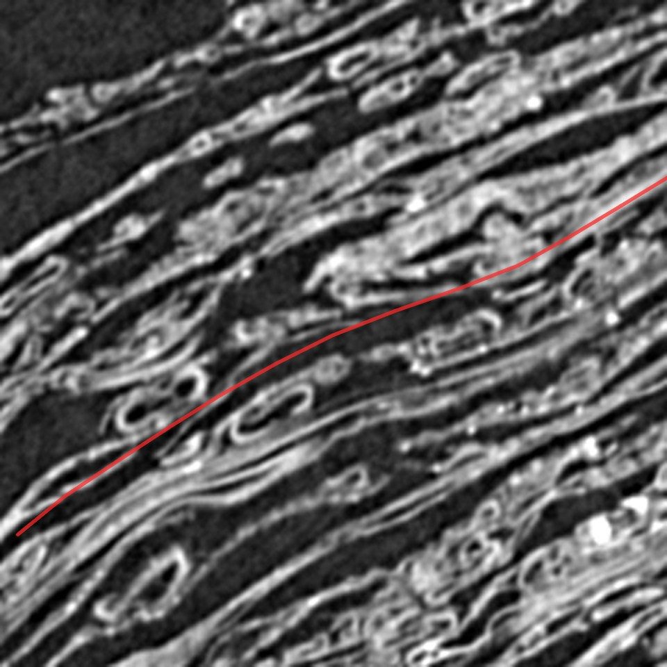 Coupe du scanner avec une ligne rouge qui longe les bandes de fibres